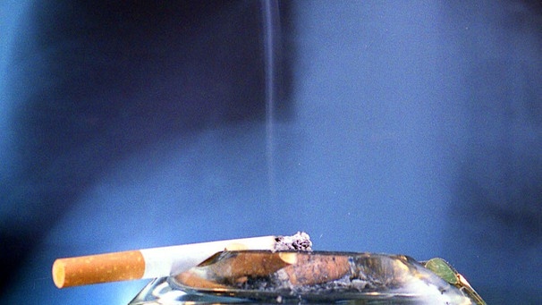 rauchende Zigarette auf einem Aschenbecher vor dem Röntgenbild eines Brustkorbs | Bild: picture-alliance/dpa