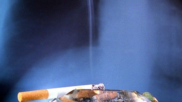 rauchende Zigarette auf einem Aschenbecher vor dem Röntgenbild eines Brustkorbs | Bild: picture-alliance/dpa